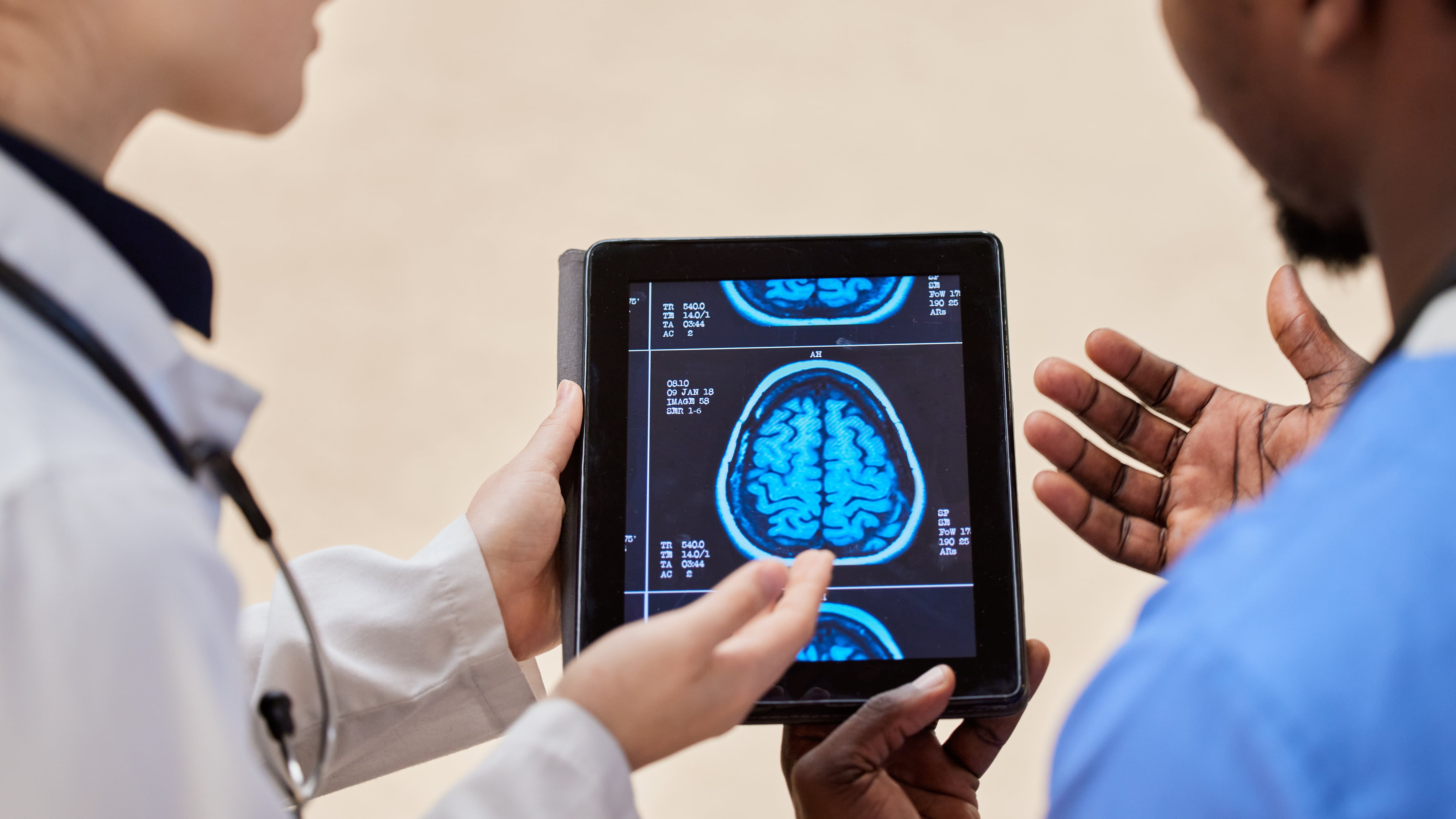 Resonancia magnética del cerebro