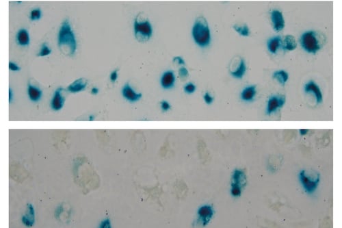 Descubren que un compuesto derivado de la anémona del mar Caribe podría mejorar el tratamiento contra el cáncer