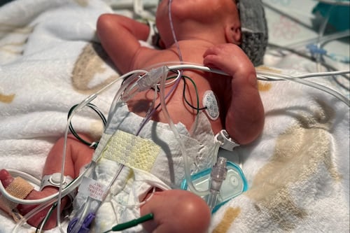 Familia de Moca pide ayuda para bebé prematuro hospitalizado desde hace dos meses