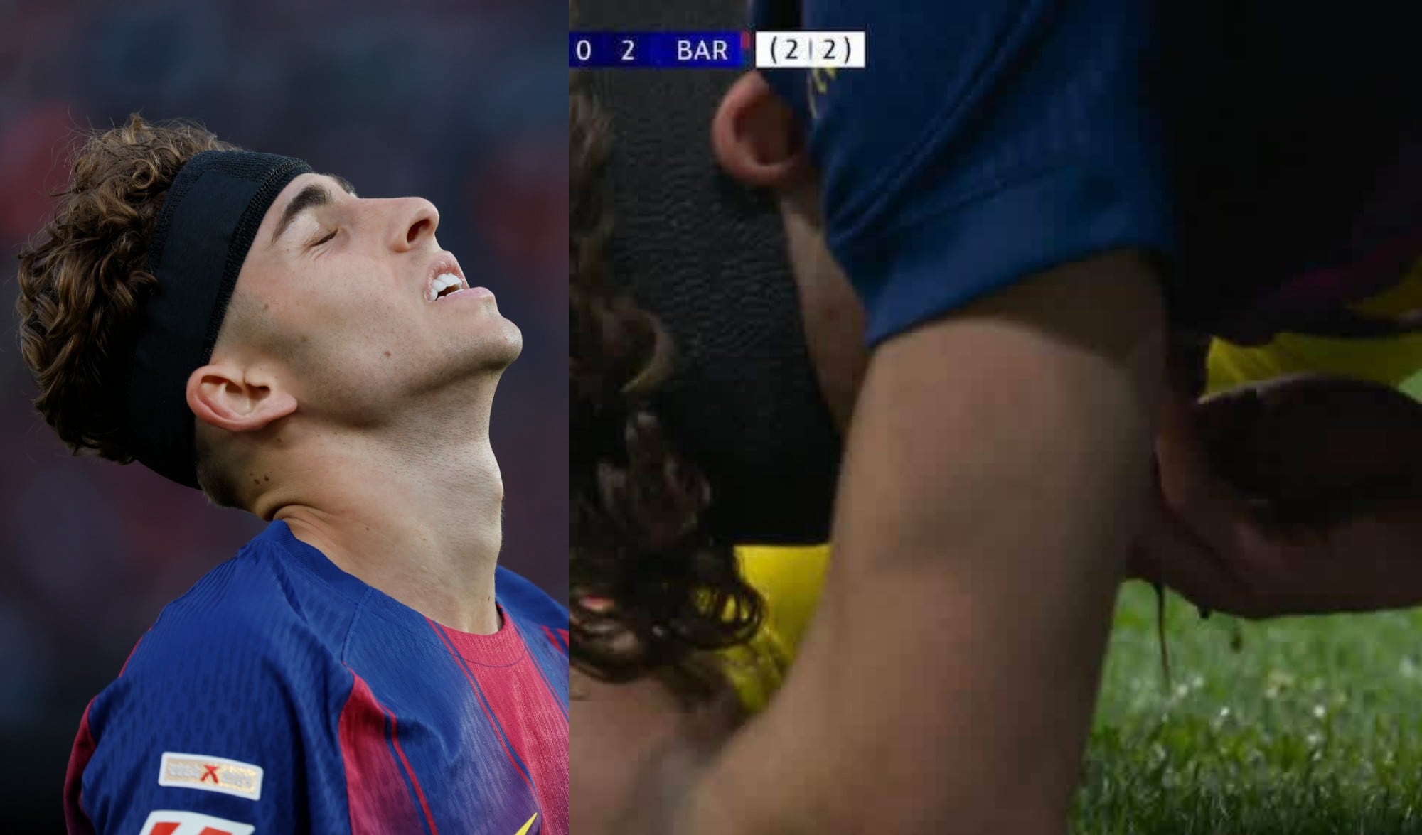 ¡Brutal! Arquero del Atlético de Madrid impacta con sus tachones el rostro de Fermín