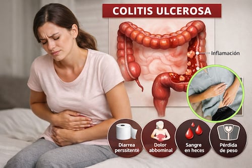 Colitis ulcerosa, estas son las 5 señales de alerta que mujeres confunden con estrés