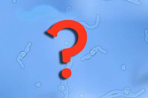 Ciencia: ¿Qué son esas manchas que observas en tus ojos?