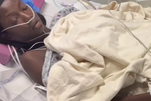 Extraña enfermedad afecta salud de famosa modelo de pasarelas