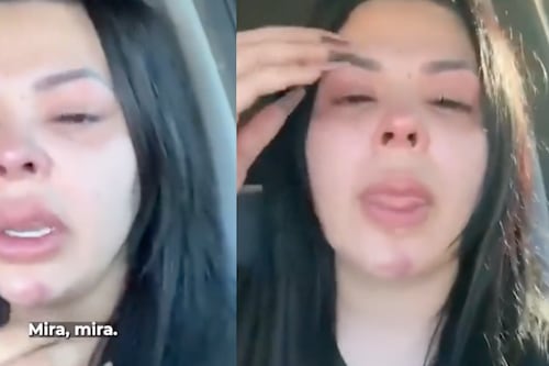 Pareja de famoso cantante estremeció al mostrar las fuertes agresiones recibidas por el hombre