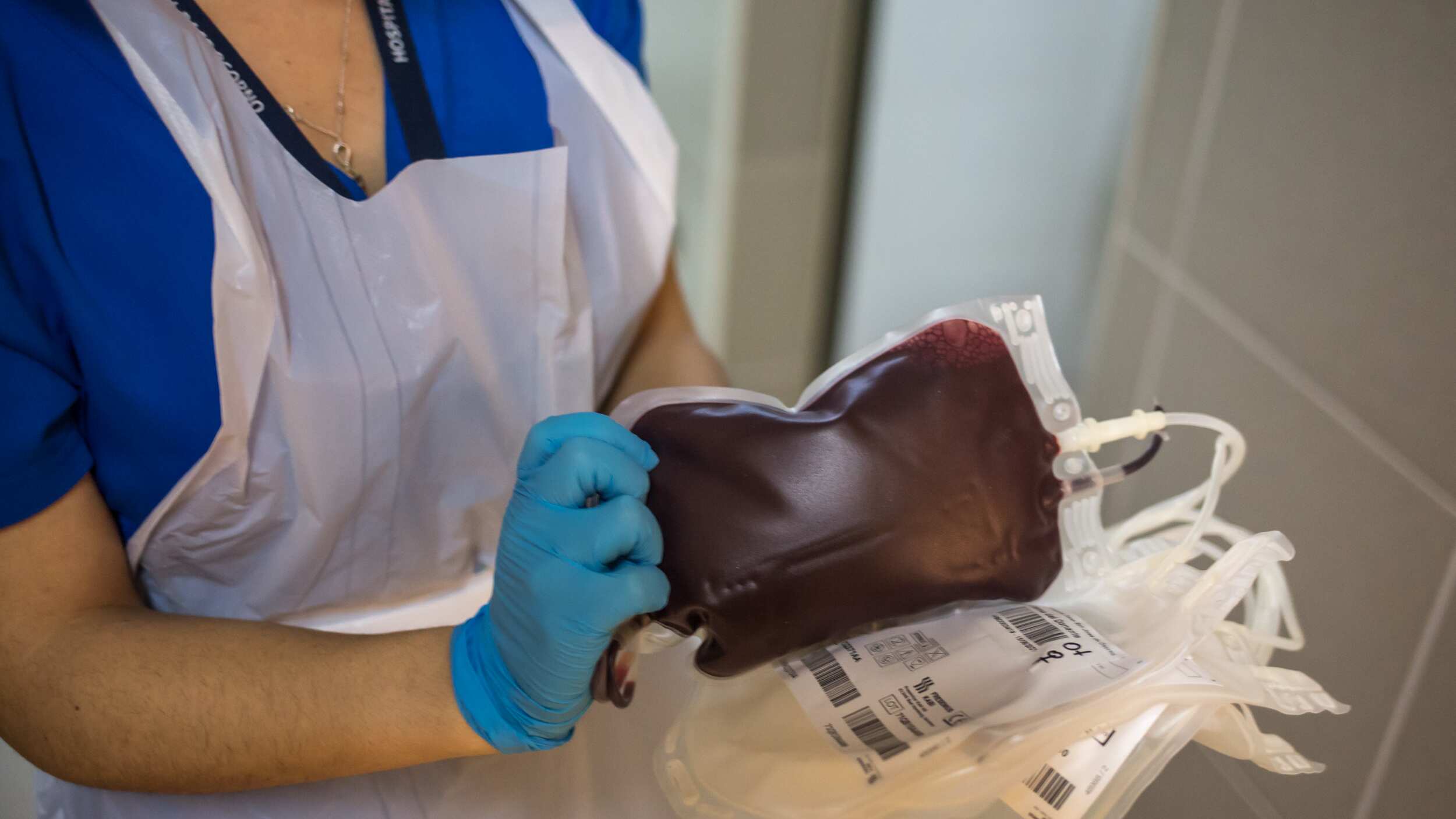 Llaman a donantes de sangre del tipo O negativo