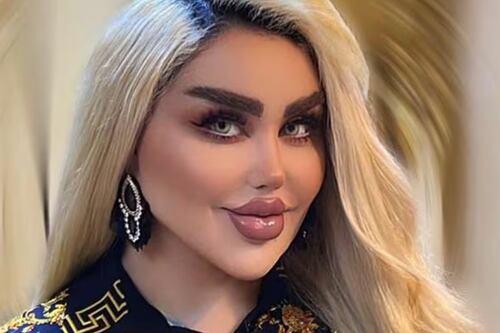 Mujer se somete a 43 cirugías para parecerse a “Barbie”